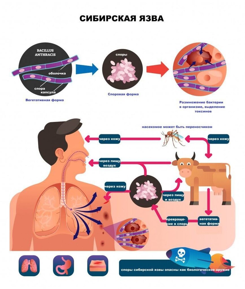 Сибирская язва - особо опасная инфекционная болезнь.